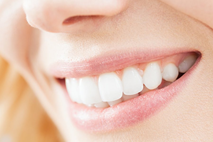 DIENTES BLANCOS A LA PRIMERA (parte 2)