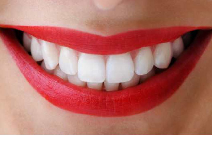DIENTES BLANCOS A LA PRIMERA (parte1)