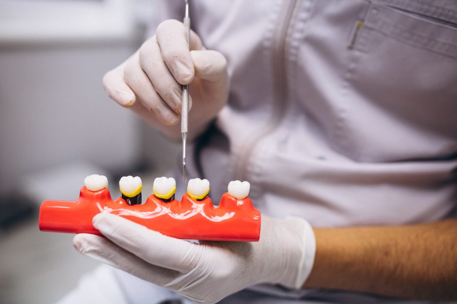 ¿La pérdida de dientes es hereditaria?