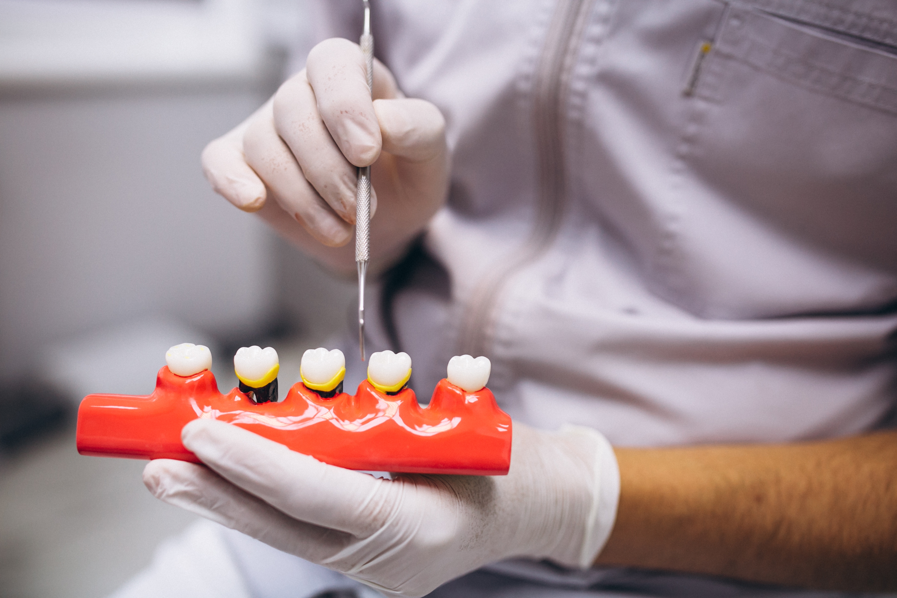 ¿La pérdida de dientes es hereditaria?